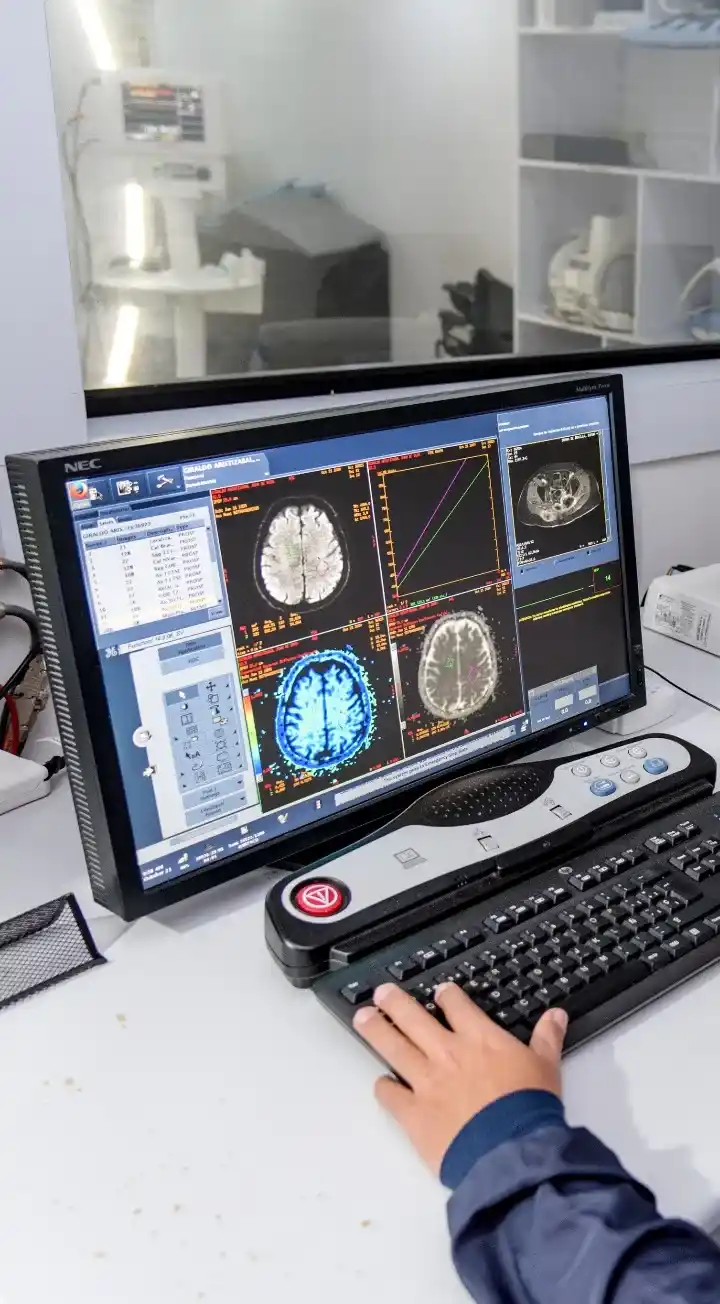 Se ve la pantalla de un computador imágenes diagnósticas de un cerebro